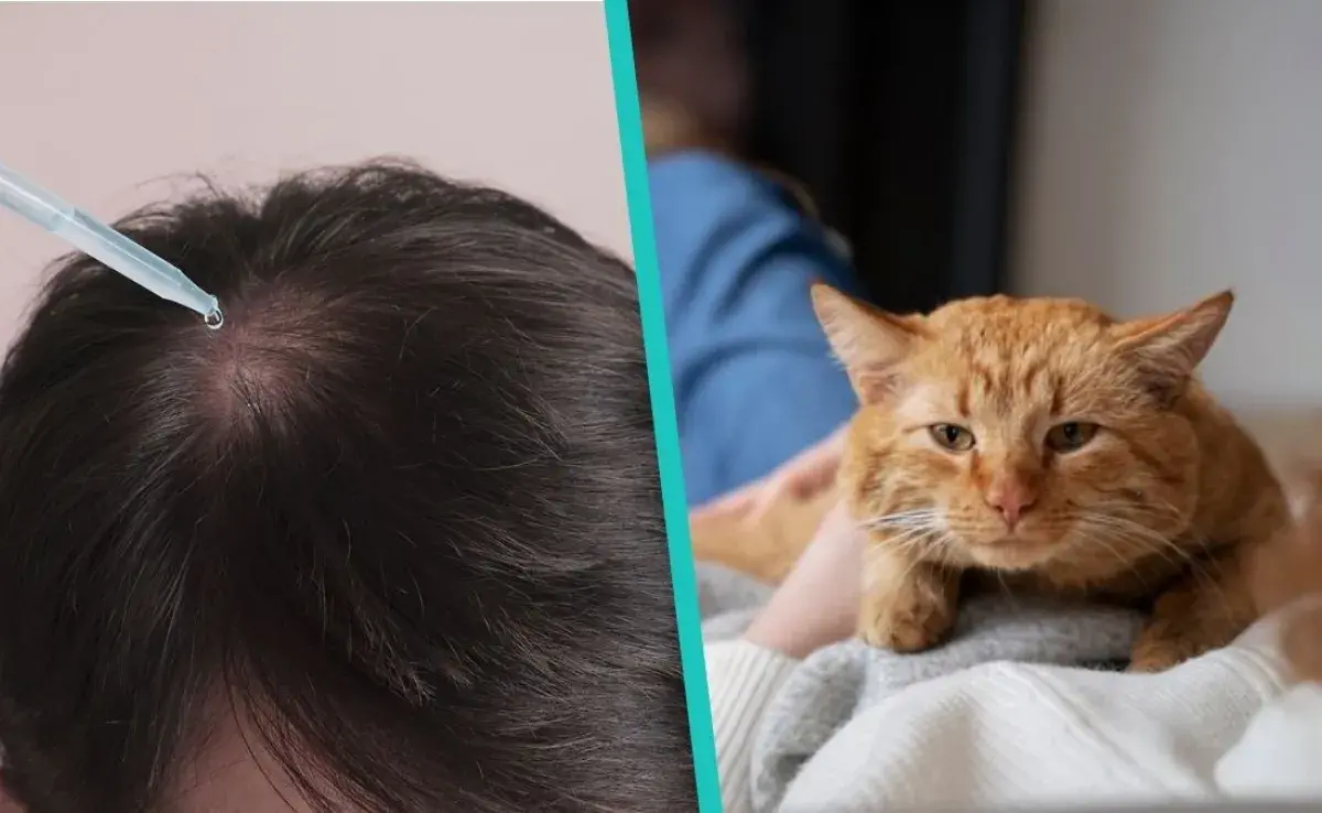 Minoxidil, famoso remedio para crecer el cabello es altamente mortal para los gatos