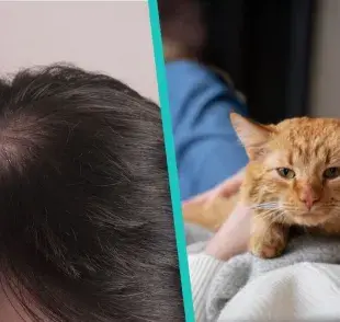 Minoxidil, famoso remedio para crecer el cabello es altamente mortal para los gatos